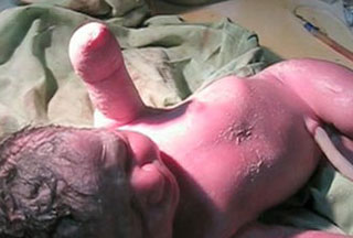 The United States takes the matter of three-headed babies very seriously