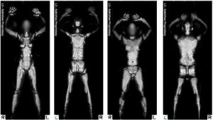 Full Body Scanners