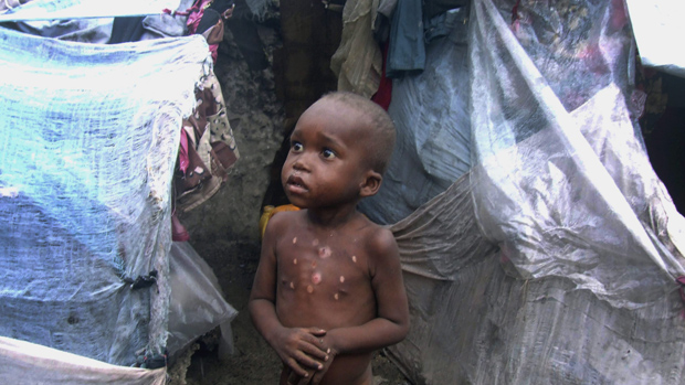 Ground Your Warplanes, Save the Horn of Africa